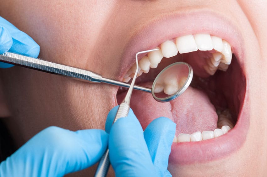 up close image of adult having teeth inspected