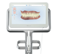 itero machine screen, technology for orthodontic appliances 